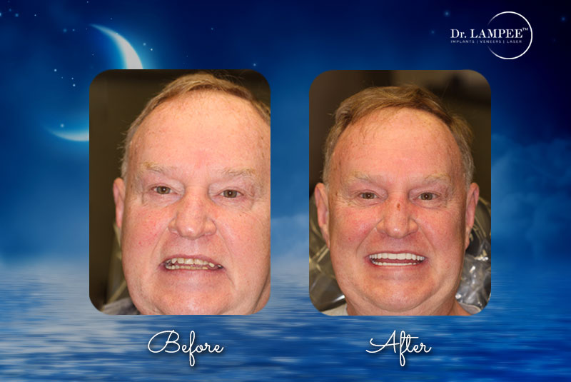 andy dental implants combined
