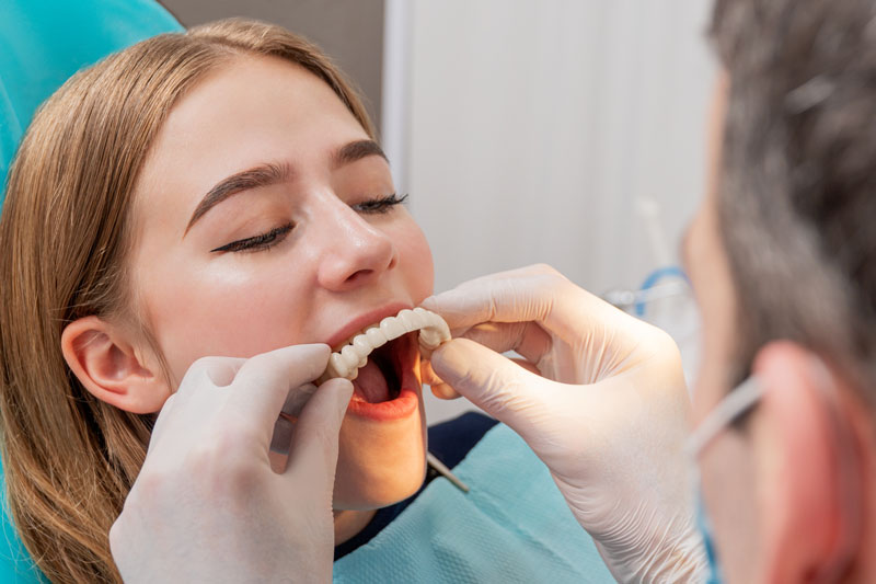 a dental patient getting her full arch prosthesis placed by a skilled doctor during her full mouth dental implant procedure.