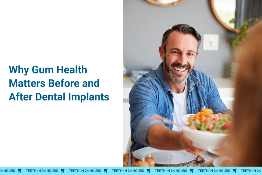 Why Gum Health Matters Before and After Dental Implants