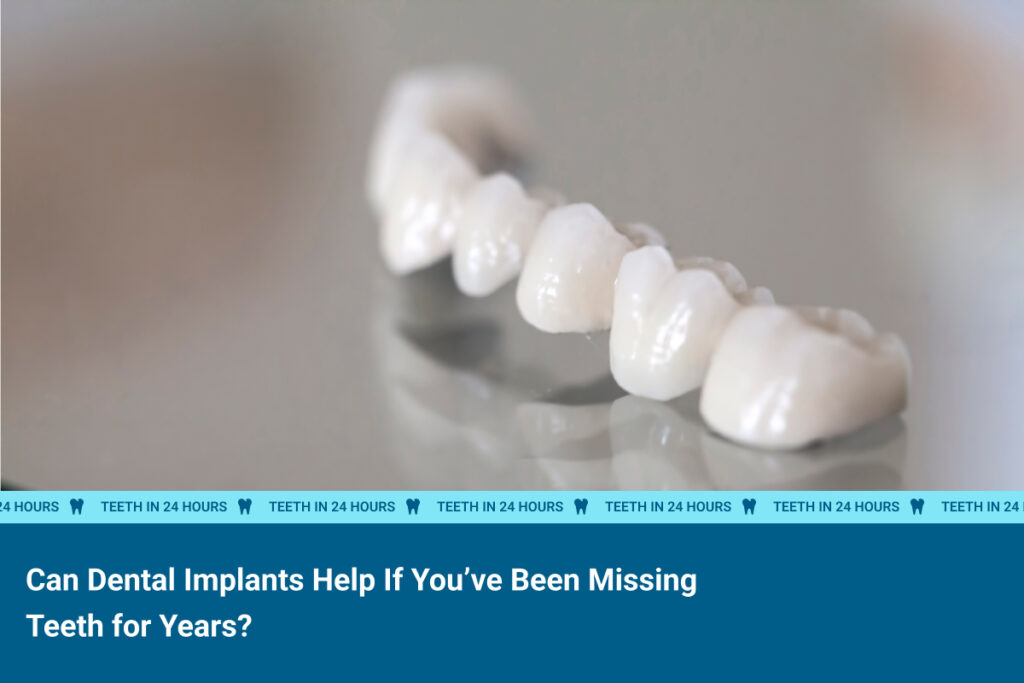 Can Dental Implants Help If You’ve Been Missing Teeth for Years?