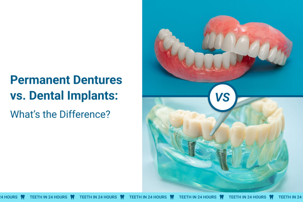 Permanent Dentures vs. Dental Implants