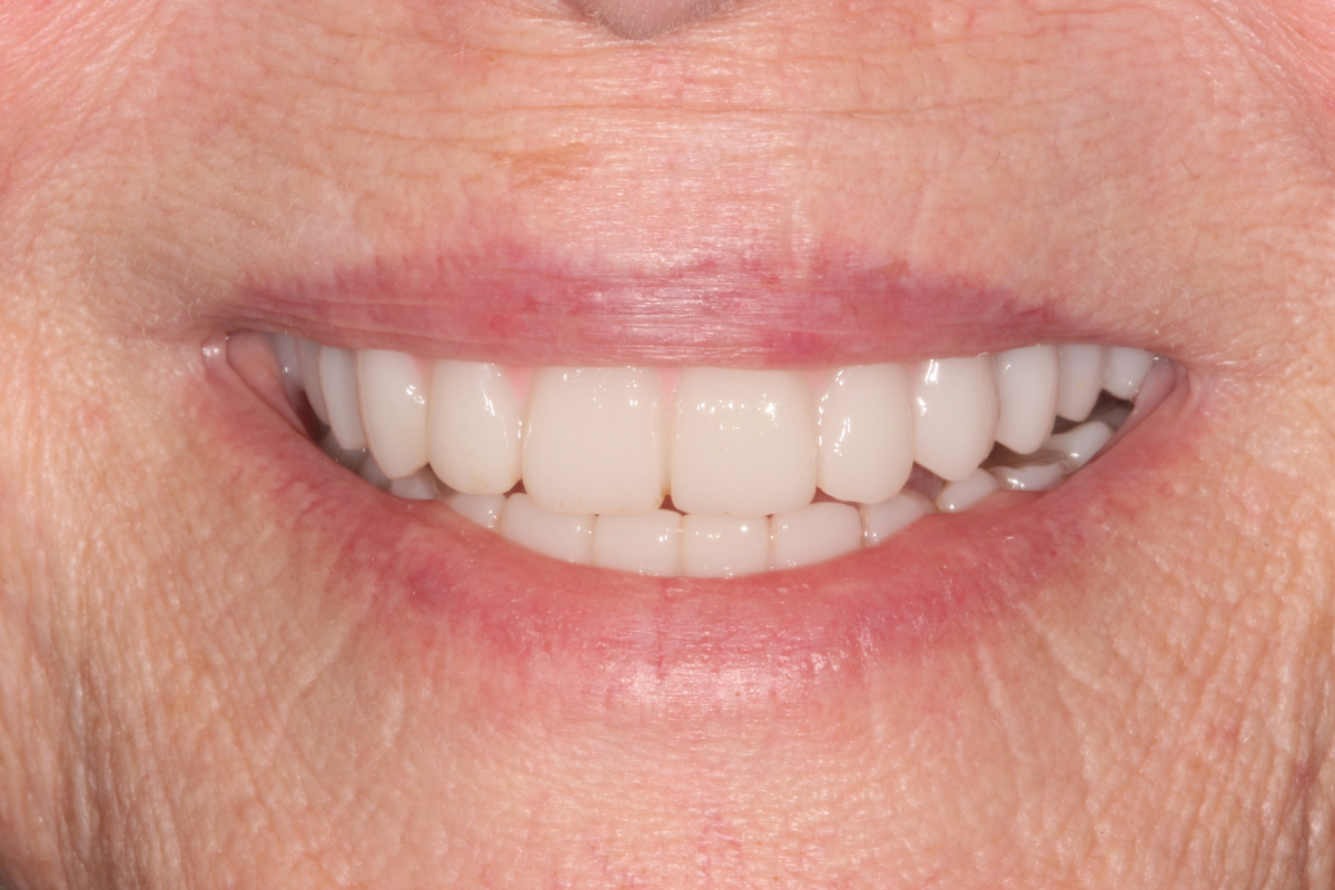Before dental treatment