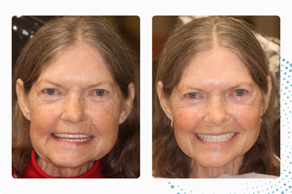 doris-cs-lampee-06-10-25