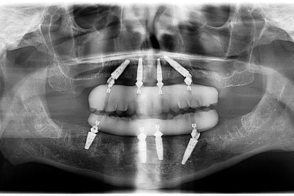 frank-2025-image-11_1