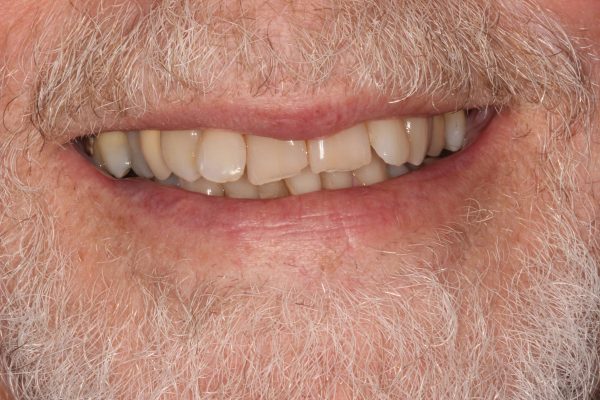 frank-2025-image-11_3