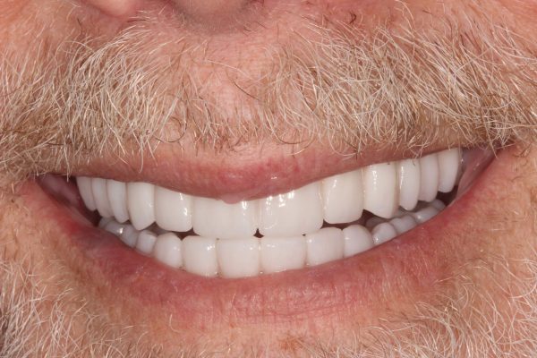 frank-2025-image-11_5