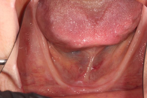 image-11-doris-06-10-25