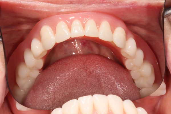 image-11_1-doris-06-10-25