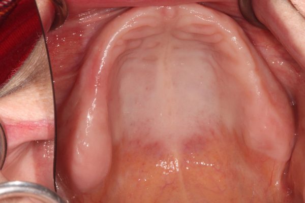 image-11_2-doris-06-10-25