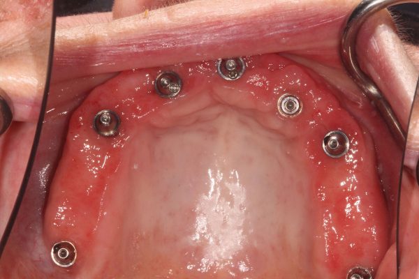 image-11_5-doris-06-10-25