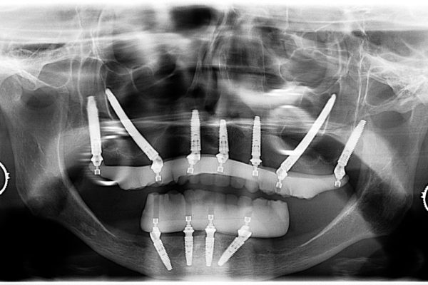 image-11_7-doris-06-10-25